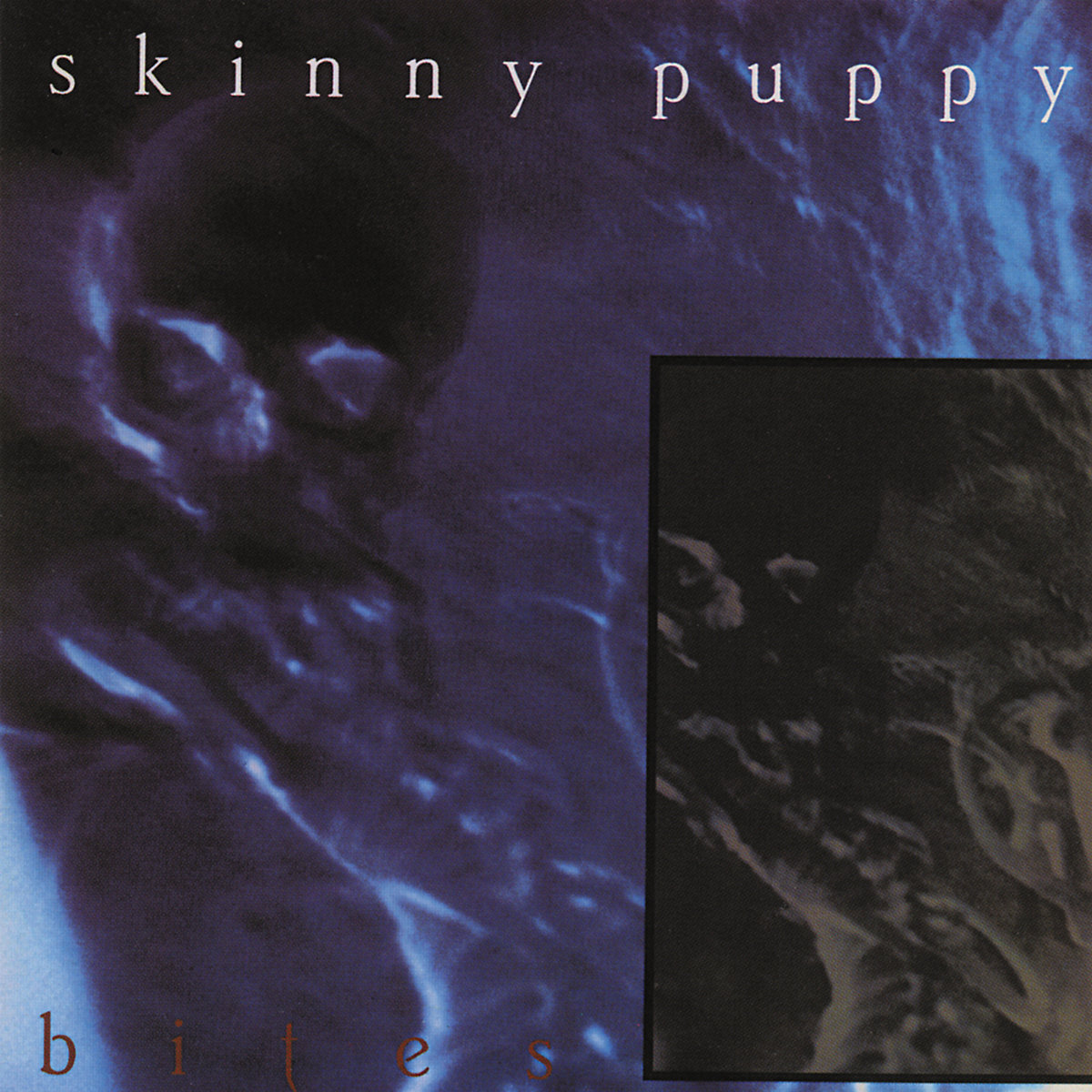 'Bites' by Skinny Puppy.